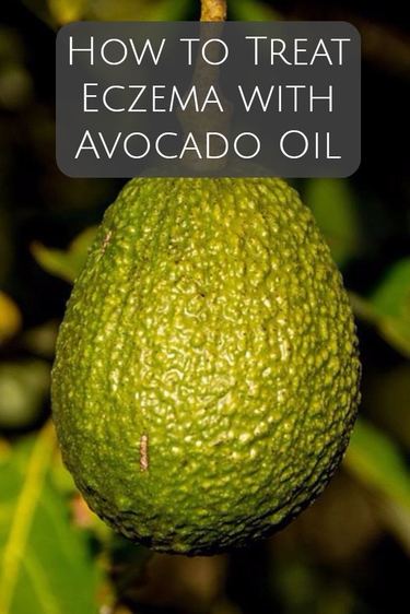 How to treat eczema with avocado oil