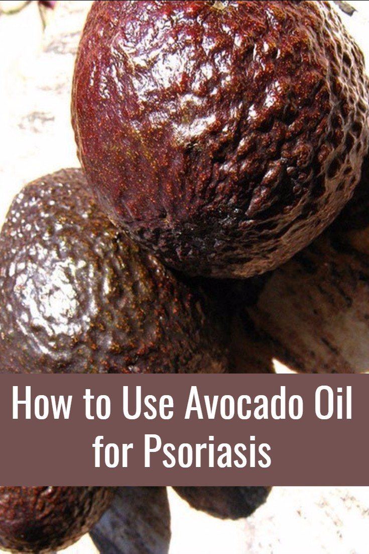 Avocado Oil as a Topical Treatment for Psoriasis
